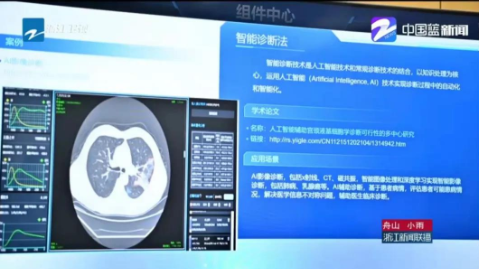 數字化改革：“啄醫生”智能輔助診斷助力“健康大腦”建設